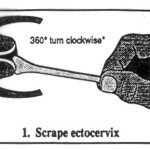 ginekologija-1