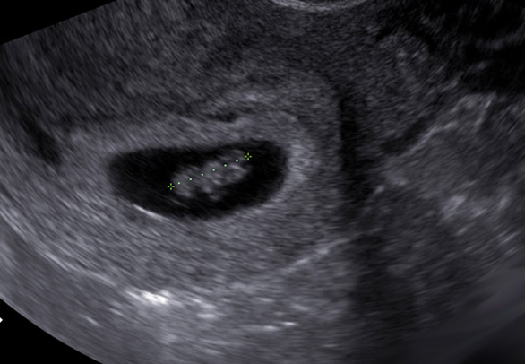 UZ Pregled Utvr ivanje Trudno e Ginekolo ka Ordinacija Dr Veber 