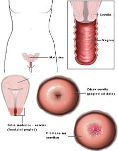 materica-i-cerviks