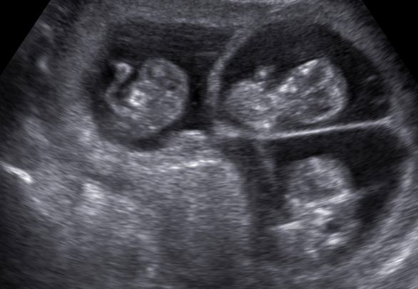 UZ Pregled Utvr ivanje Trudno e Ginekolo ka Ordinacija Dr Veber 